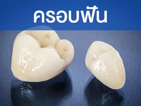 ครอบฟัน