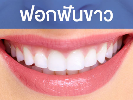 ฟอกสีฟัน