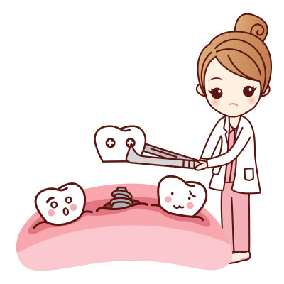 ขั้นตอนการรักษารากฟันเทียมที่ 3