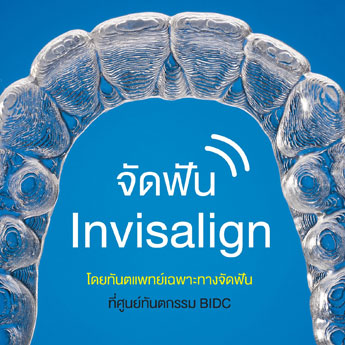 จัดฟันใสที่ไหนดี