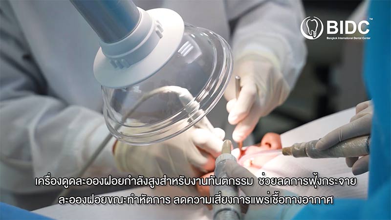 เครื่องดูดละอองฝอย