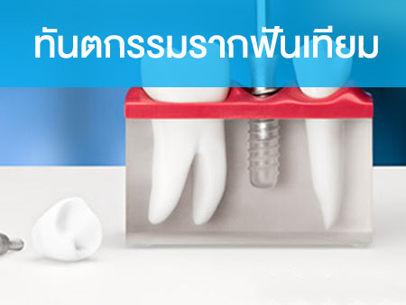 ทันตกรรมรากฟันเทียม