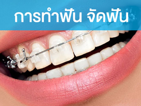 การทำฟัน จัดฟัน