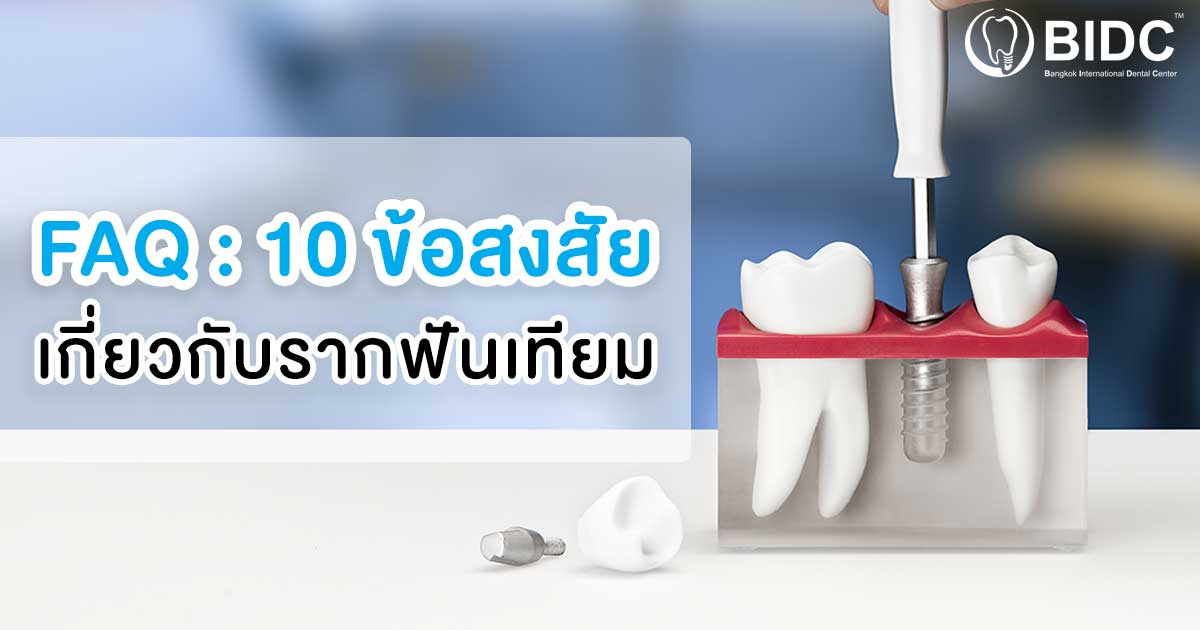 รากฟันเทียม