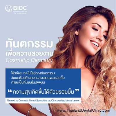 วีเนียร์ ฟันสวยแบบดารา