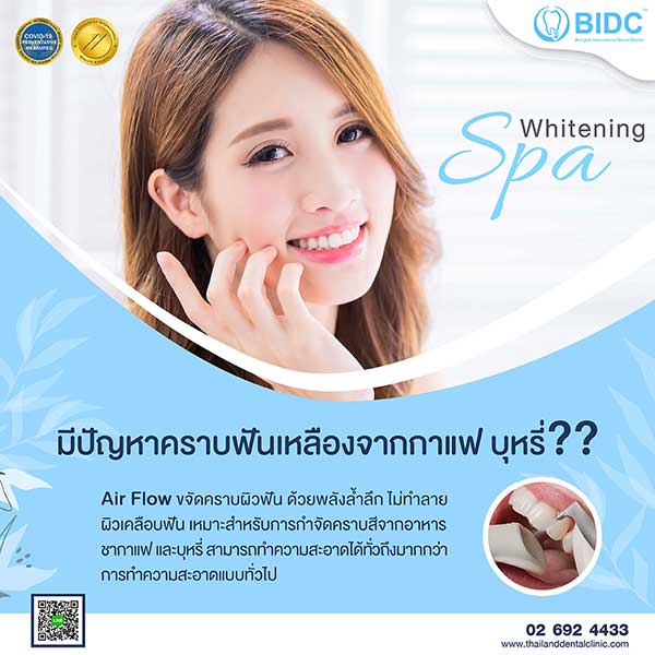 ขัดฟันขาว