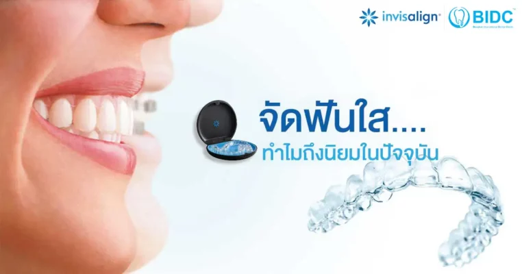 จัดฟันใส Invisalign ราคา