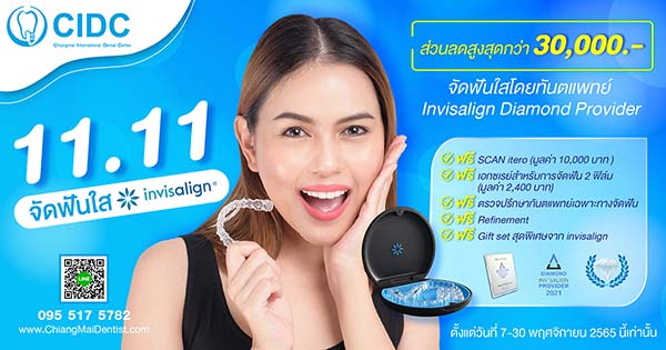 โปรโมชั่น invisalign เชียงใหม่
