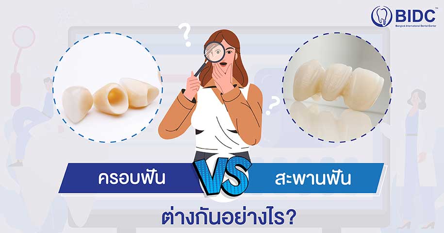 ครอบฟัน สะพานฟัน