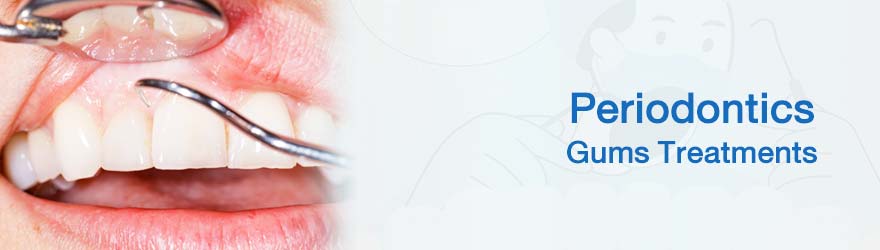 ราคาปลูกเหงือก ตัดเหงือก