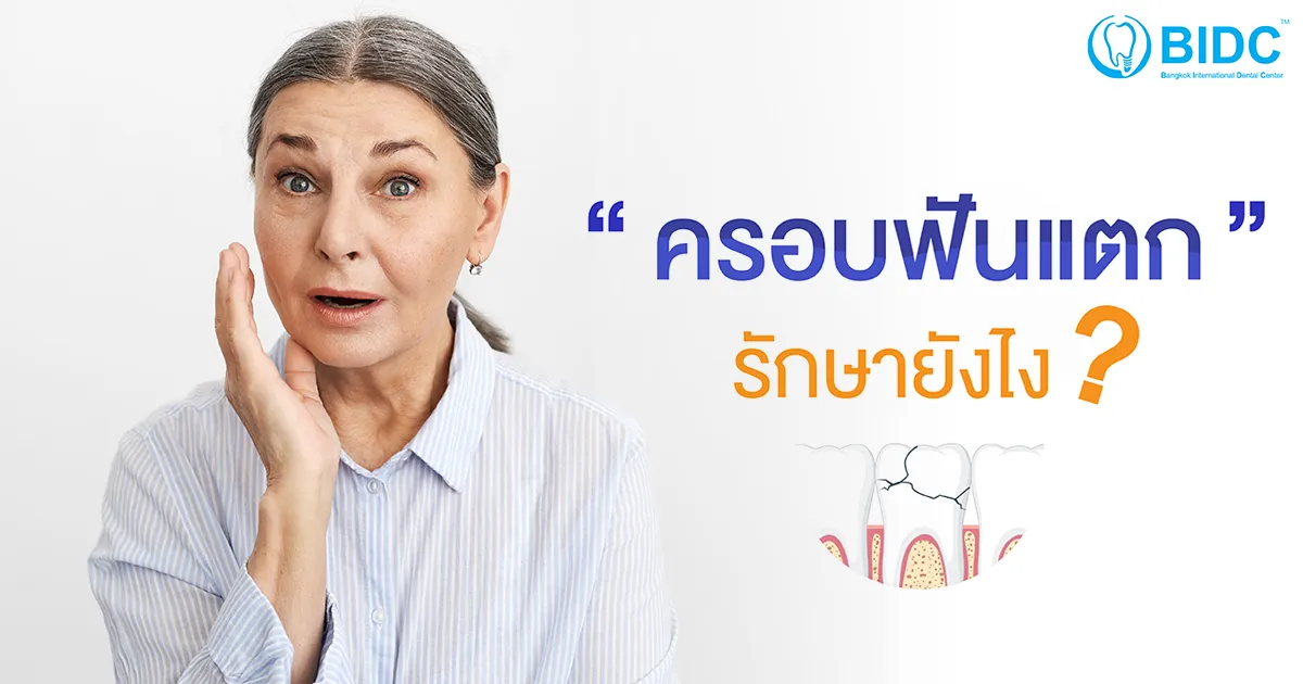 ครอบฟันแตก หลุด หัก ร้าว ทำยังไงดี ? | ศูนย์ทันตกรรม Bidc