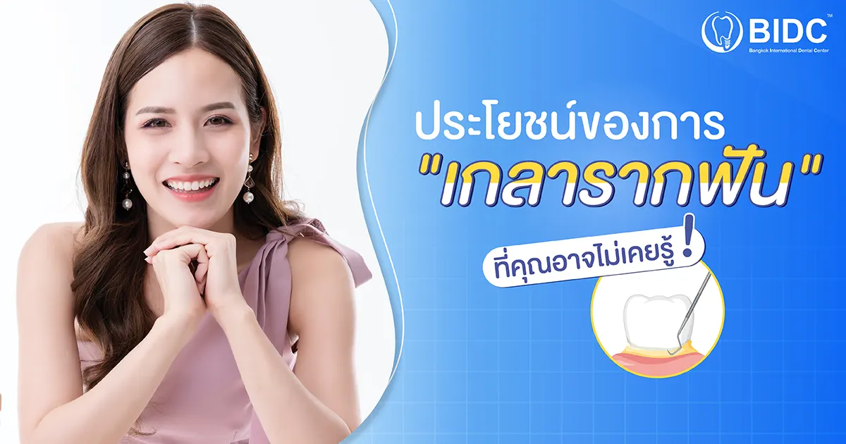 เกลารากฟัน