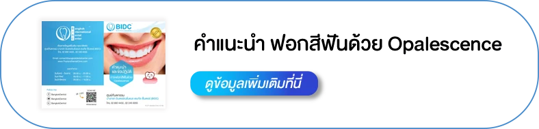 หลังฟอกสีฟันที่บ้านดูแลตัวเองยังไง