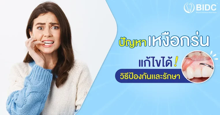 เหงือกร่น