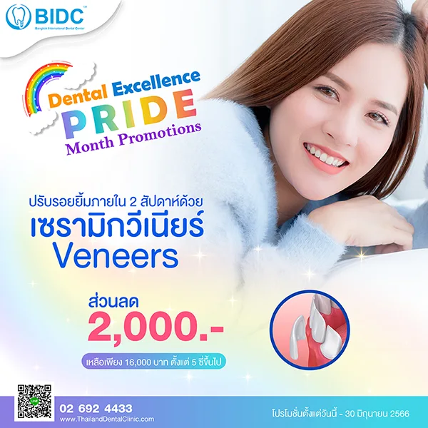 วีเนียร์ ราคา