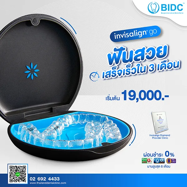 จัดฟันใส iGo ราคา