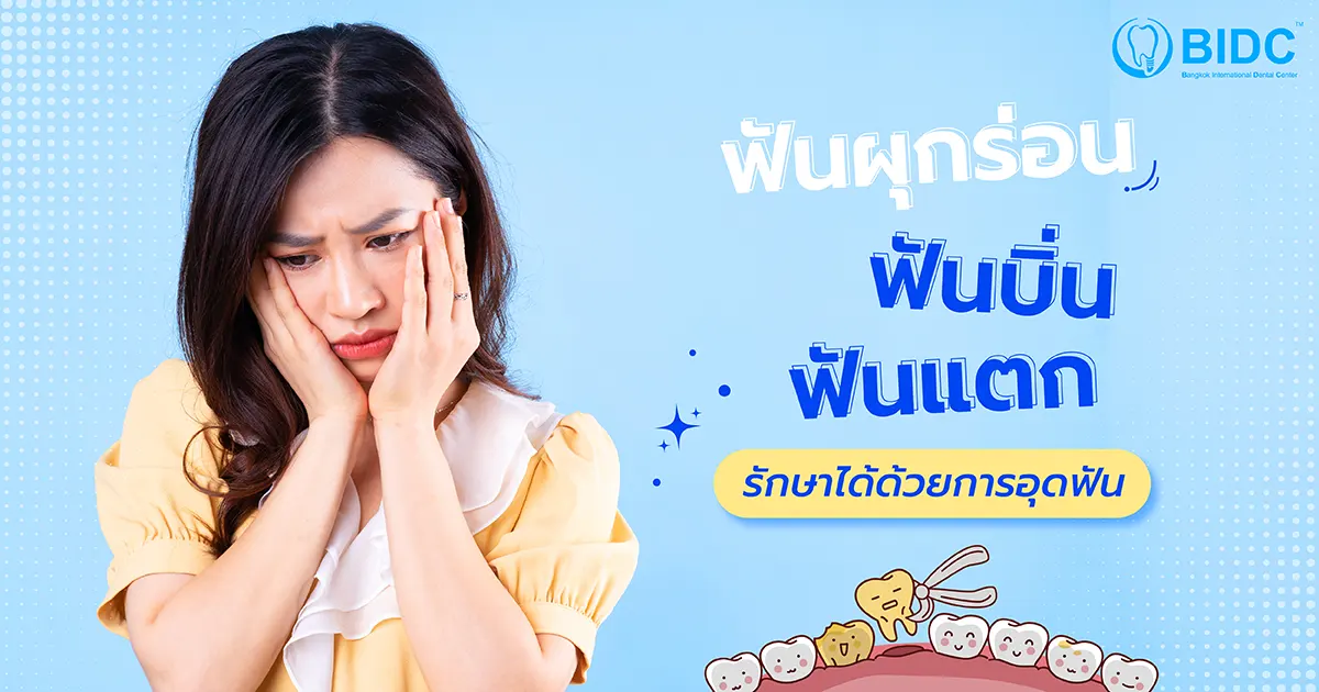 อุดฟันแบบไหนดี