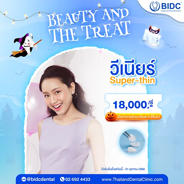 วีเนียร์ ราคา