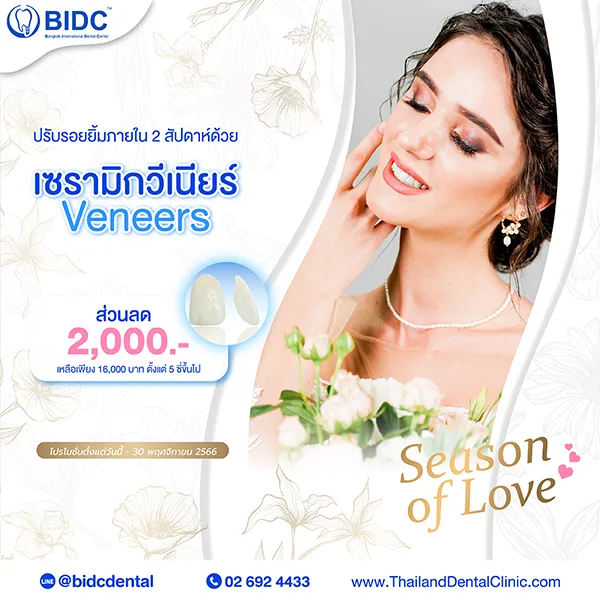 วีเนียร์ ราคา