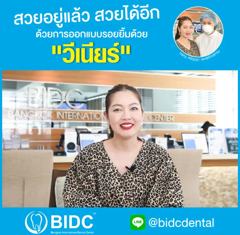 รีวิวทำวีเนียร์ ฟันขาวสวย