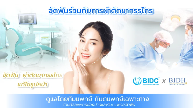 ผ่าตัดขากรรไกร