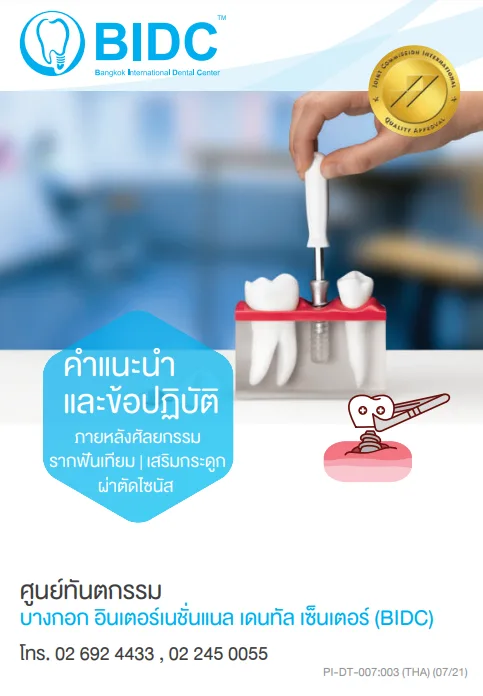 วิธีการดูแลรักษาหลังปลูกกระดูกฟัน