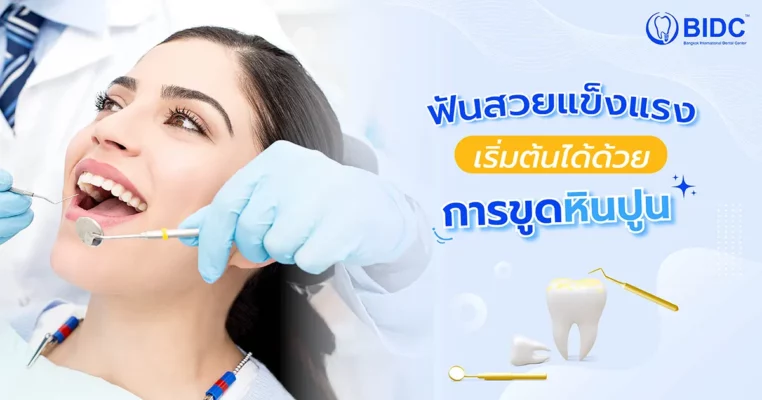 การขูดหินปูน