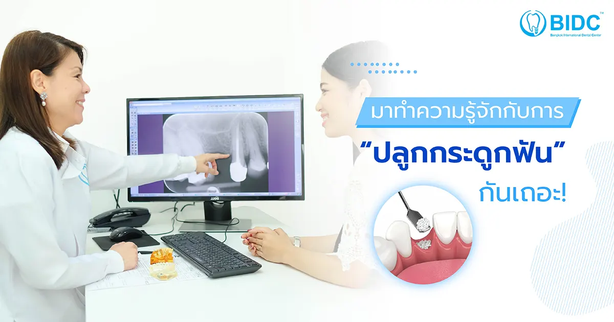 ปลูกกระดูกฟัน