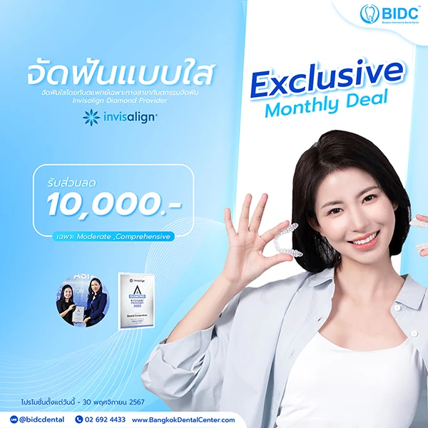 จัดฟันใส ราคา 2567