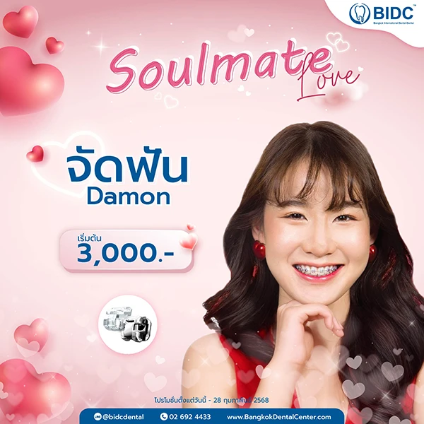 โปรโมชั่นจัดฟัน 3000