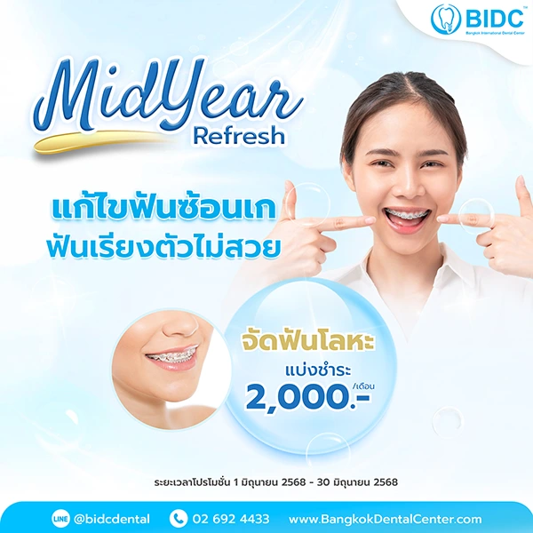 โปรโมชั่นจัดฟัน 3000