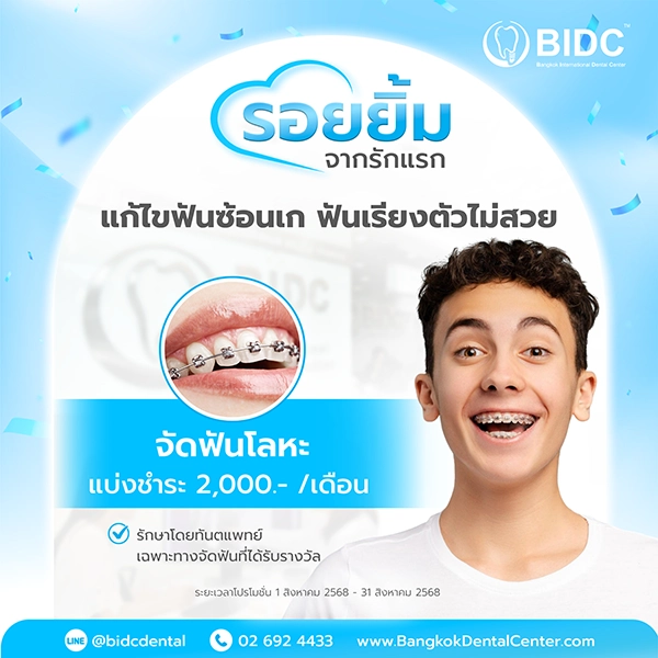 โปรโมชั่นจัดฟัน 2000