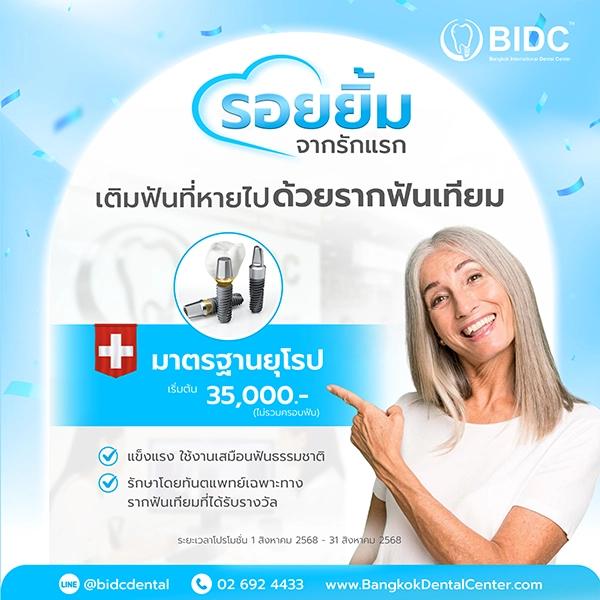 ราคา รากฟันเทียม