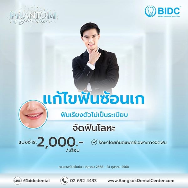 โปรโมชั่นจัดฟัน 2000