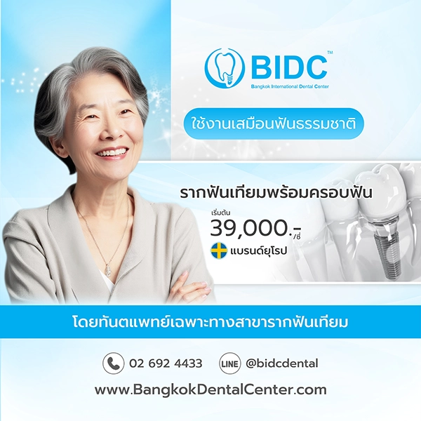 ราคา รากฟันเทียม