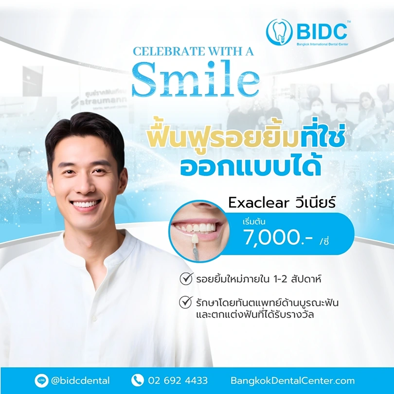 ทำวีเนียร์ที่ไหนดี