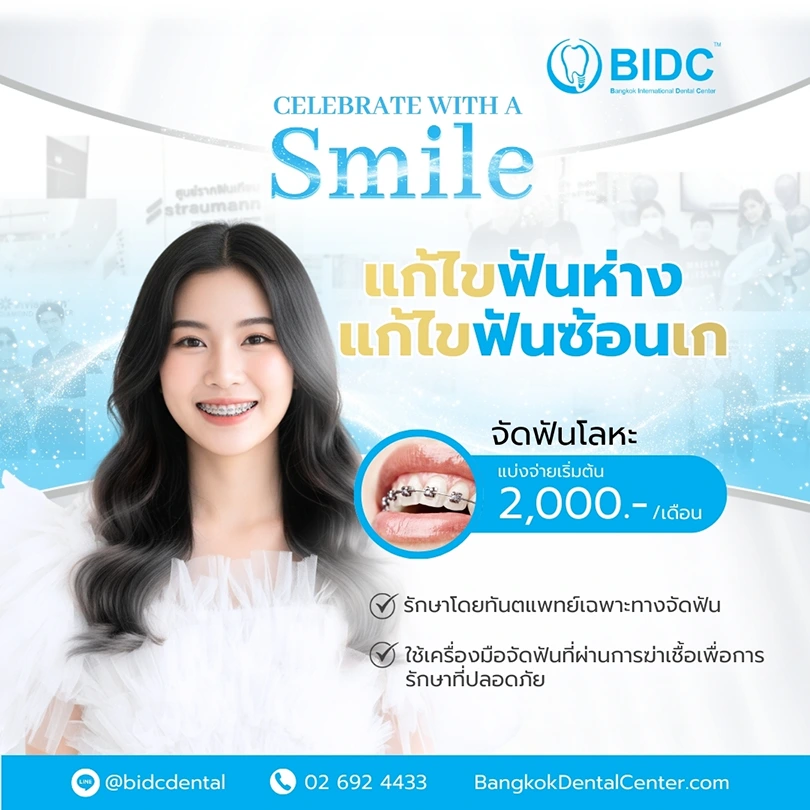 โปรโมชั่นจัดฟัน 2000