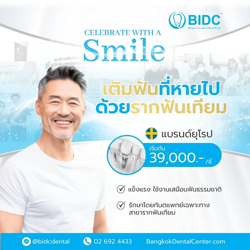 ราคา รากฟันเทียม