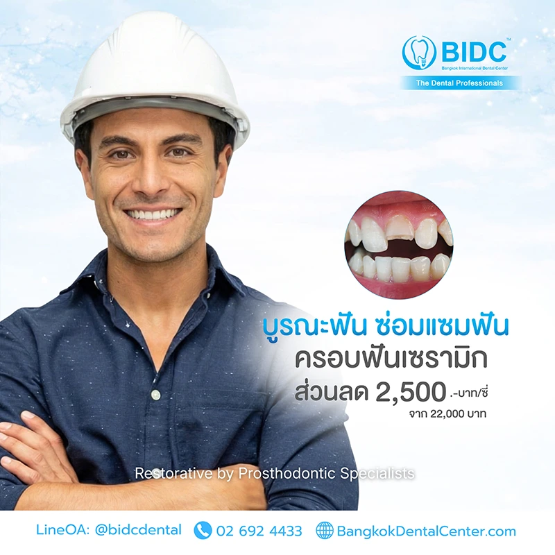 ครอบฟัน ราคา