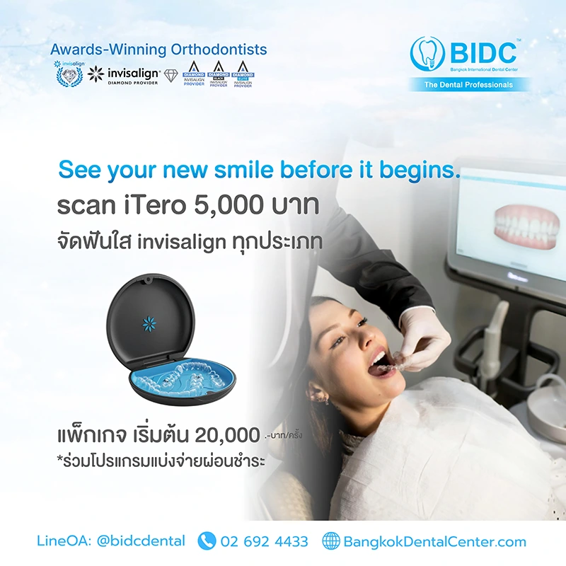 จัดฟันใส ราคา 2569