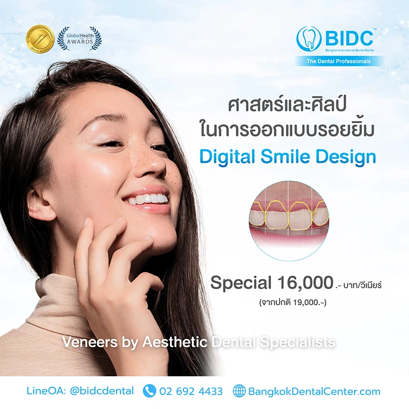 ทำวีเนียร์ที่ไหนดี