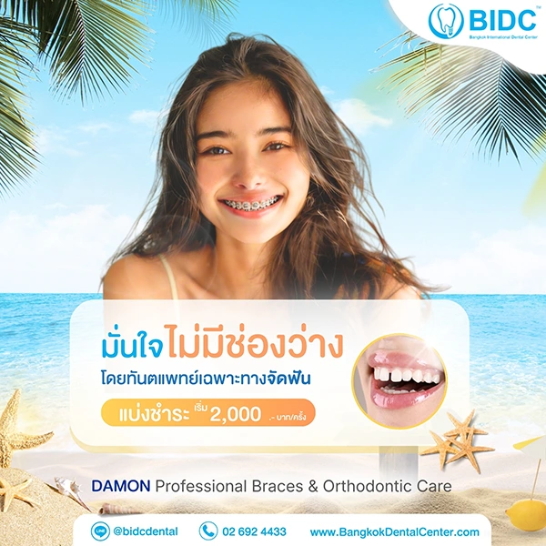 โปรโมชั่นจัดฟัน 2000