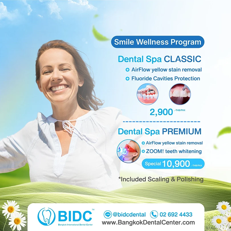 โปรโมชั่นฟอกฟันขาว